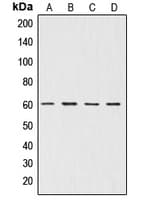 Polyclonal Rabbit anti-Human AKT1 + AKT2 + AKT3 Antibody (Internal, IHC, WB)