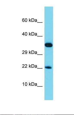 RPL28 / Ribosomal Protein L28 Antibody (aa43-92)