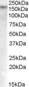 PathPlus™ DNMT / DNMT1 Antibody (aa891-904)