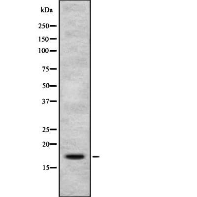 PIP / GCDFP-15 Antibody