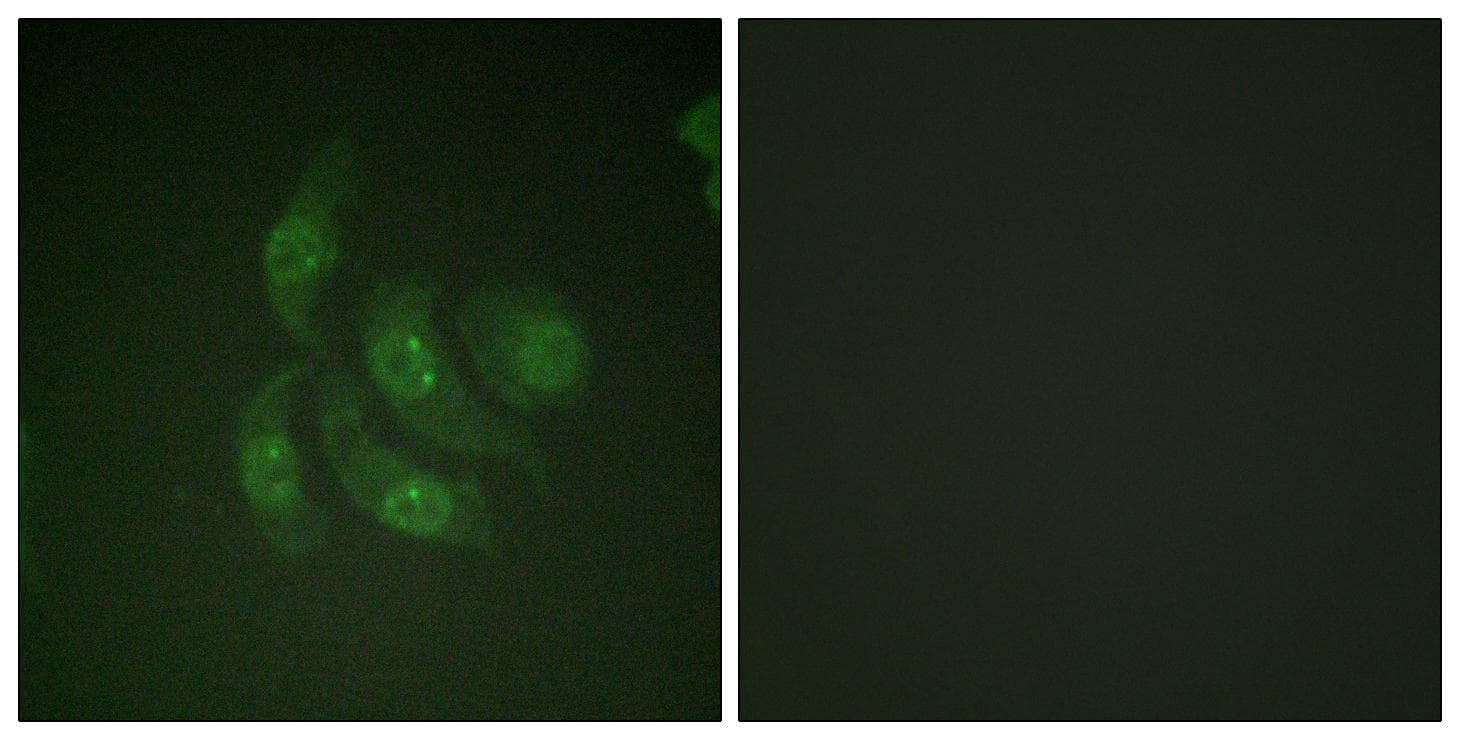 Polyclonal Rabbit anti-Human CAMK4 / CaMK IV Antibody (p196/200, IHC, IF, WB)
