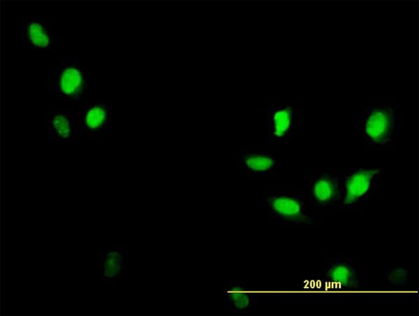 Monoclonal Mouse anti-Human CDK1 / CDC2 Antibody (clone 1A4-1A9, IHC, IF, WB)