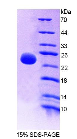 Human OPTIMEDIN / OLFM3 Protein (Recombinant His-T7)