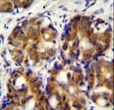 Polyclonal Rabbit anti-Human HMMR / CD168 / RHAMM Antibody (aa668-697, IHC, WB)