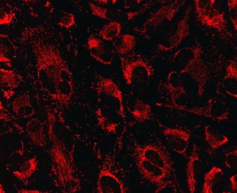 HSDL2 Antibody (clone 2A11BG6AH6)