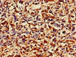 Polyclonal Rabbit anti-Human RUNX3 Antibody (IHC, IF, WB)