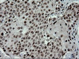 TRMT2A Antibody (clone OTI1H8, Carrier-free)