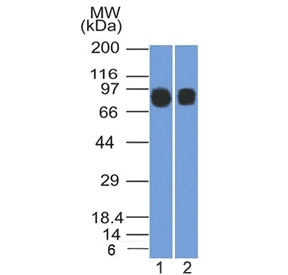 MME / CD10 Antibody (clone MME/1892)
