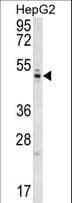 Polyclonal Rabbit anti-Human WDR12 Antibody (aa210-239, IHC, WB)