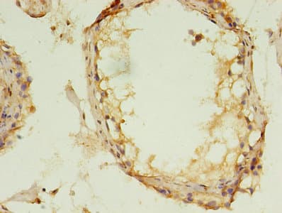 MAPK13 / p38delta Antibody