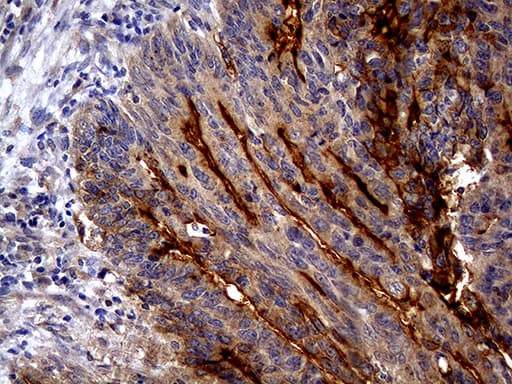 ABCB1 / MDR1 / P Glycoprotein Antibody (aa995-1280, clone OTI2H2)