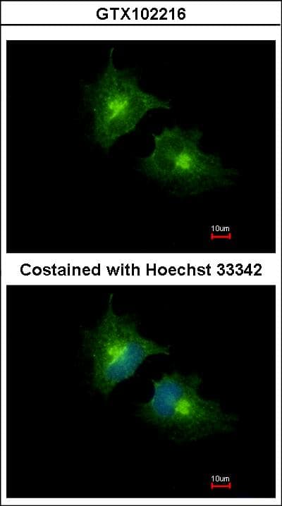 SCAMP3 Antibody (aa1-165)