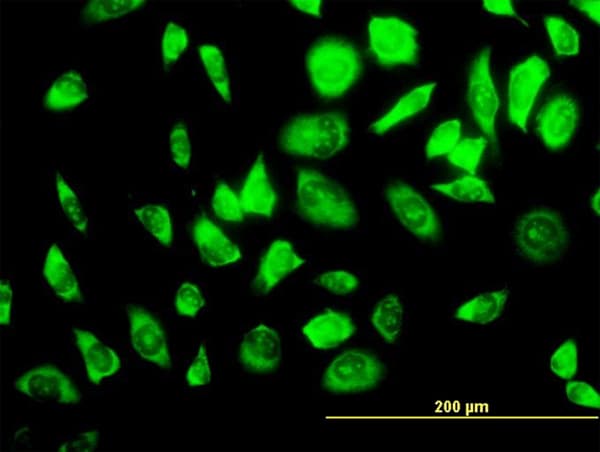 RPS23 / Ribosomal Protein S23 Antibody (clone 1E3)