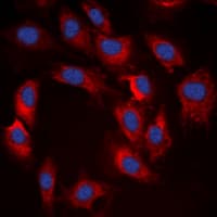 Polyclonal Rabbit anti-Human RPS6KB1 / P70S6K / S6K Antibody (phospho-Thr412, IHC, IF, WB)