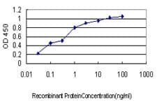 Corneodesmosin / CDSN Antibody (clone 6F11)