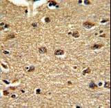 CLUAP1 Antibody (aa379-408)