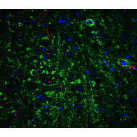Polyclonal Rabbit anti-Human APP / Beta Amyloid Precursor Antibody (IHC, IF, WB)