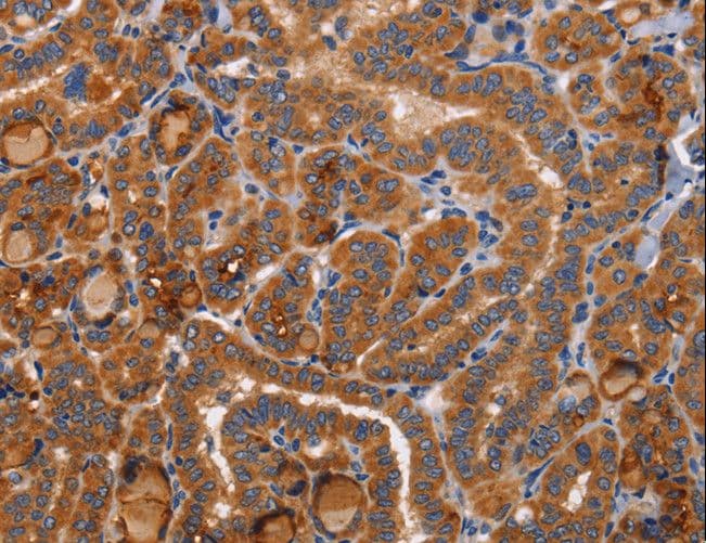 BMP6 Antibody