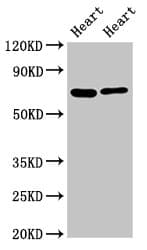 Polyclonal Rabbit anti-Human FASTKD2 Antibody (IHC, WB)