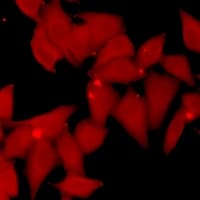 SMYD3 Antibody