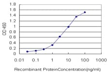 IHC-plus™ Monoclonal Mouse anti-Human AGTRAP / ATRAP Antibody (clone 1G2, IHC, WB)