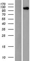 Human EIF3C / EIF3S8 Protein (Over-Expression Lysate Myc-DDK (Flag))