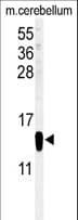 IHC-plus™ FABP7 / BLBP / MRG Antibody (aa104-132)