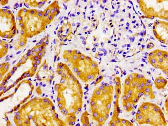 FZD10 / Frizzled 10 Antibody