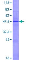 Human IFNE / Interferon Epsilon Protein (Recombinant GST)
