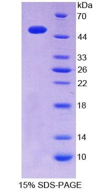 Mouse ITPA Protein (Recombinant His-GST)