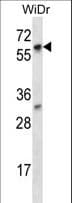 LARP7 Antibody (aa527-556)