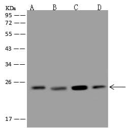 Polyclonal Rabbit anti-Human MAD2L1 / MAD2 Antibody (IHC, IF, WB)