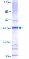 Human HR6B / UBE2B Protein (Recombinant GST)