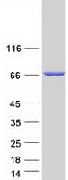 Human ALOX12 / 12 Lipoxygenase Protein (Recombinant Myc-DDK (Flag))