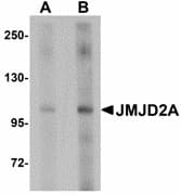 IHC-plus™ KDM4A / JHDM3A / JMJD2A Antibody