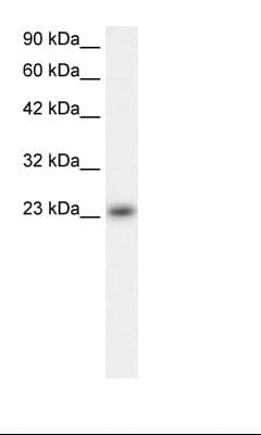 Polyclonal Rabbit anti-Human MXD4 Antibody (N-Terminus, IHC, WB)