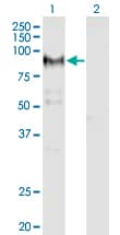 ADAM12 Antibody (clone 1G3)