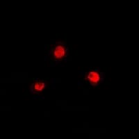 Polyclonal Rabbit anti-Human PRDM7 Antibody (IF, WB)