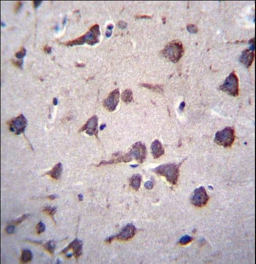 FKTN / Fukutin Antibody (aa177-206)