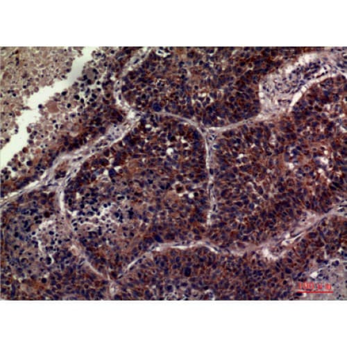 Polyclonal Rabbit anti-Human CD63 Antibody (121-170 aa, Internal, IHC, WB)