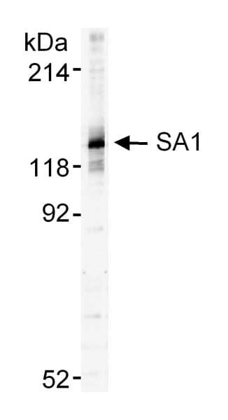 IHC-plus™ STAG1 / SA1 Antibody (aa25-75)