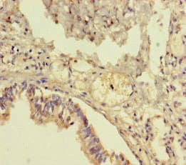 Polyclonal Rabbit anti-Human TMEM64 Antibody (IHC, WB)