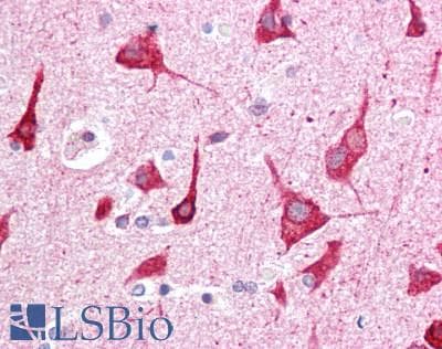 ST3GAL5 / GM3 Synthase Antibody