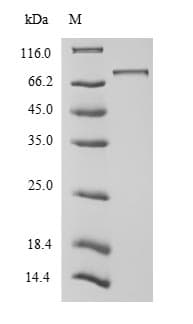 Human UBTF / UBF Protein (Recombinant 10His-SUMO, N-terminus)