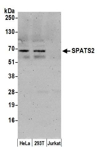 SPATS2 Antibody (aa450-500)