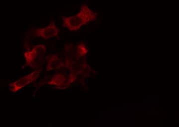AGPAT9 / MAG1 Antibody
