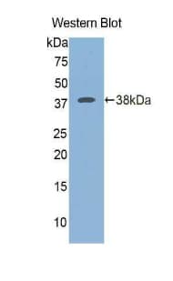 ICA69 / ICA1 Antibody (aa1-257, Biotin)