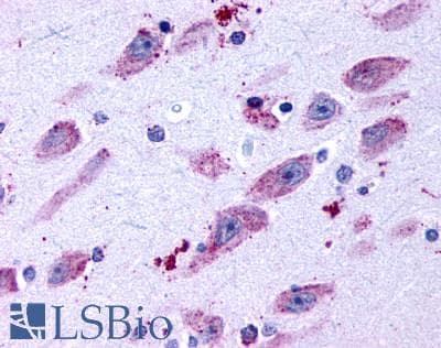 PathPlus™ Polyclonal Rabbit anti-Human DRD4 / Dopamine Receptor D4 Antibody (C-Terminus, IHC)