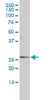 IHC-plus™ ORM1 / Orosomucoid Antibody (clone 2F9-1F10)