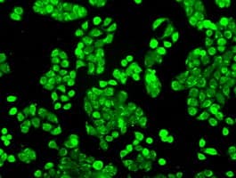Monoclonal Mouse anti-Human CYPOR / POR Antibody (clone OTI3F10, IHC, IF, WB)